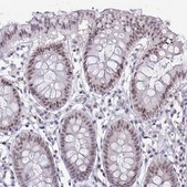 Anti-RBL1 antibody produced in rabbit Prestige Antibodies&#174; Powered by Atlas Antibodies, affinity isolated antibody, buffered aqueous glycerol solution