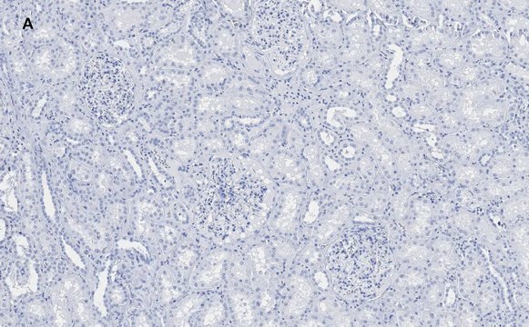 Anti-Nestin Antibody, clone 8B8, ZooMAb&#174; Rabbit Monoclonal recombinant, expressed in HEK 293 cells