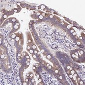 Anti-ABCC3 antibody produced in rabbit Prestige Antibodies&#174; Powered by Atlas Antibodies, affinity isolated antibody, buffered aqueous glycerol solution