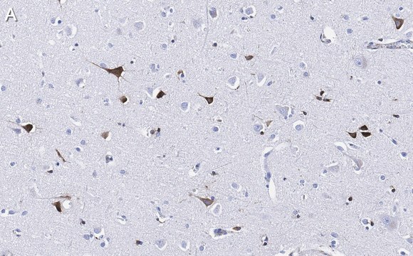 Anti-Prion Protein Antibody, clone 3F17 ZooMAb&#174; Rabbit Monoclonal recombinant, expressed in HEK 293 cells