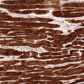 Monoclonal Anti-Tnnt2 Antibody Produced In Mouse Prestige Antibodies&#174; Powered by Atlas Antibodies, clone CL13403, affinity isolated antibody, buffered aqueous glycerol solution