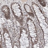 Anti-TRIM66 antibody produced in rabbit Prestige Antibodies&#174; Powered by Atlas Antibodies, affinity isolated antibody, buffered aqueous glycerol solution