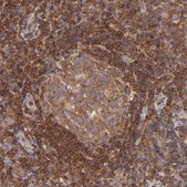 Anti-BTK antibody produced in rabbit Ab2, Prestige Antibodies&#174; Powered by Atlas Antibodies, affinity isolated antibody, buffered aqueous glycerol solution
