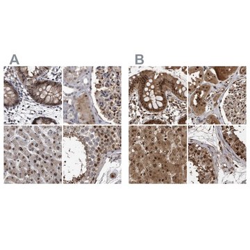 Anti-RAD23B antibody produced in rabbit Prestige Antibodies&#174; Powered by Atlas Antibodies, affinity isolated antibody, buffered aqueous glycerol solution, ab3