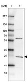 Anti-MIF4GD antibody produced in rabbit Prestige Antibodies&#174; Powered by Atlas Antibodies, affinity isolated antibody, buffered aqueous glycerol solution