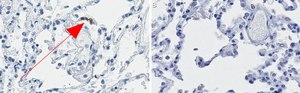 Anti-ACE2-cytoplasmic Antibody, clone 1C17 ZooMAb&#174; Rabbit Monoclonal recombinant, expressed in HEK 293 cells