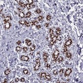 Anti-TRPS1 Prestige Antibodies&#174; Powered by Atlas Antibodies, affinity isolated antibody