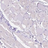 Anti-CD40 antibody produced in rabbit Prestige Antibodies&#174; Powered by Atlas Antibodies, affinity isolated antibody, buffered aqueous glycerol solution