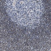 Anti-NOP58 antibody produced in rabbit Prestige Antibodies&#174; Powered by Atlas Antibodies, affinity isolated antibody, buffered aqueous glycerol solution
