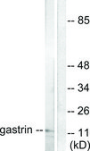 Anti-Gastrin antibody produced in rabbit affinity isolated antibody