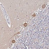 Anti-NARS antibody produced in rabbit Prestige Antibodies&#174; Powered by Atlas Antibodies, affinity isolated antibody, buffered aqueous glycerol solution