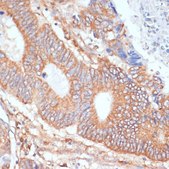 Anti-ENO1 antibody produced in rabbit