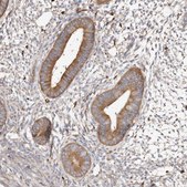 Anti-CAP1 antibody produced in rabbit Prestige Antibodies&#174; Powered by Atlas Antibodies, affinity isolated antibody, buffered aqueous glycerol solution