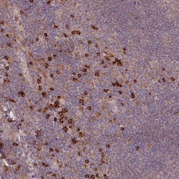 Anti-MPEG1 antibody produced in rabbit Prestige Antibodies&#174; Powered by Atlas Antibodies, affinity isolated antibody, buffered aqueous glycerol solution