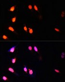 Anti-SETD2 antibody produced in rabbit
