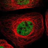 Anti-RBM5 antibody produced in rabbit Prestige Antibodies&#174; Powered by Atlas Antibodies, affinity isolated antibody, buffered aqueous glycerol solution
