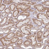 Anti-TIMMDC1 antibody produced in rabbit Prestige Antibodies&#174; Powered by Atlas Antibodies, affinity isolated antibody, buffered aqueous glycerol solution