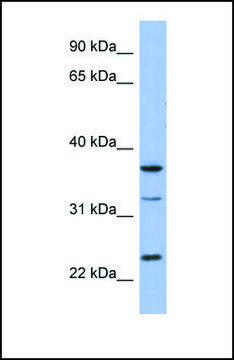 Anti-SOX21 antibody produced in rabbit affinity isolated antibody