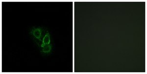 Anti-RAD antibody produced in rabbit affinity isolated antibody