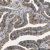Anti-TLN1 antibody produced in rabbit Prestige Antibodies&#174; Powered by Atlas Antibodies, affinity isolated antibody, buffered aqueous glycerol solution