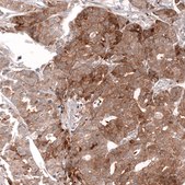 Monoclonal Anti-Lgr5 Antibody Produced In Mouse Prestige Antibodies&#174; Powered by Atlas Antibodies, clone CL13567, affinity isolated antibody, buffered aqueous glycerol solution