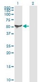 Monoclonal Anti-ALDH1A1 antibody produced in mouse clone 1G6, purified immunoglobulin, buffered aqueous solution