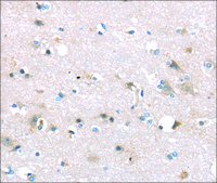 Anti-TTI1 affinity isolated antibody