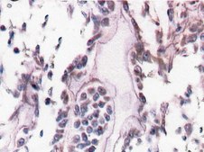 Anti-Bone Sialoprotein II Antibody, CT, clone ID1.2 clone ID1.2, Chemicon&#174;, from mouse