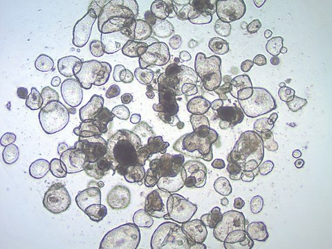 3dGRO&#174; Duodenum Intestinal Organoids, Age 56 (Prep 84-D) Cryopreserved patient derived gastrointestinal organoids (PDOs)