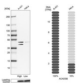 Anti-ACADSB antibody produced in rabbit Prestige Antibodies&#174; Powered by Atlas Antibodies, affinity isolated antibody, buffered aqueous glycerol solution