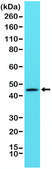 Anti-Cytokeratin-20 antibody, Rabbit Monoclonal recombinant, expressed in HEK 293 cells, clone RM283, purified immunoglobulin