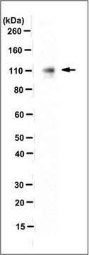 Anti-Desmocollin-2 Antibody, clone 7G6 clone 7G6, from mouse