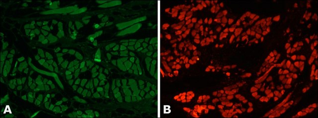 Anti-Myosin (Skeletal) antibody produced in rabbit whole antiserum