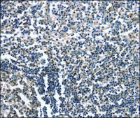 Anti-CAMTA1 antibody produced in rabbit affinity isolated antibody