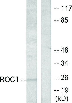 Anti-RIT1 antibody produced in rabbit affinity isolated antibody