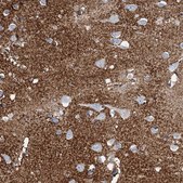 Anti-SLC1A3 antibody produced in rabbit Prestige Antibodies&#174; Powered by Atlas Antibodies, affinity isolated antibody, buffered aqueous glycerol solution