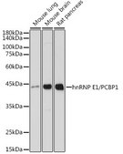 Anti-hnRNP E1/PCBP1 Antibody, clone 7M1K0, Rabbit Monoclonal