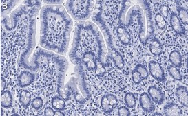 Anti-ATM Antibody, clone 4N19, ZooMAb&#174; Rabbit Monoclonal recombinant, expressed in HEK 293 cells