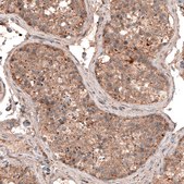 Monoclonal Anti-LAPTM4B antibody produced in mouse Prestige Antibodies&#174; Powered by Atlas Antibodies, clone CL5287, purified immunoglobulin, buffered aqueous glycerol solution