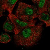 Anti-CARD8 antibody produced in rabbit Prestige Antibodies&#174; Powered by Atlas Antibodies, affinity isolated antibody, buffered aqueous glycerol solution