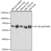 Anti-NF-kB p65/RelA antibody produced in mouse