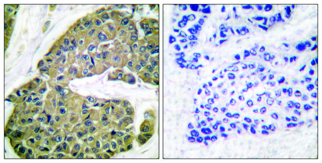 Anti-Keratin 5 antibody produced in rabbit affinity isolated antibody