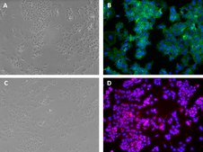 HCI-EC-23 Human Endometrial Cancer Cell Line