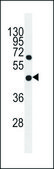 ANTI-GDPD1 (N-TERM) antibody produced in rabbit IgG fraction of antiserum, buffered aqueous solution