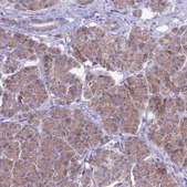 Anti-ETFDH antibody produced in rabbit Prestige Antibodies&#174; Powered by Atlas Antibodies, affinity isolated antibody, buffered aqueous glycerol solution