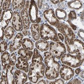 Anti-BCL10 antibody produced in rabbit Prestige Antibodies&#174; Powered by Atlas Antibodies, affinity isolated antibody, buffered aqueous glycerol solution