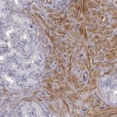 Anti-PGM5 Prestige Antibodies&#174; Powered by Atlas Antibodies, affinity isolated antibody