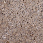 Anti-VPS53 antibody produced in rabbit affinity isolated antibody, buffered aqueous glycerol solution