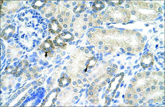 Anti-EZH2 antibody produced in rabbit affinity isolated antibody