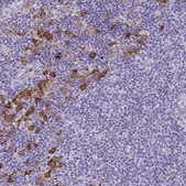 Anti-TLR7 antibody produced in rabbit Prestige Antibodies&#174; Powered by Atlas Antibodies, affinity isolated antibody, buffered aqueous glycerol solution